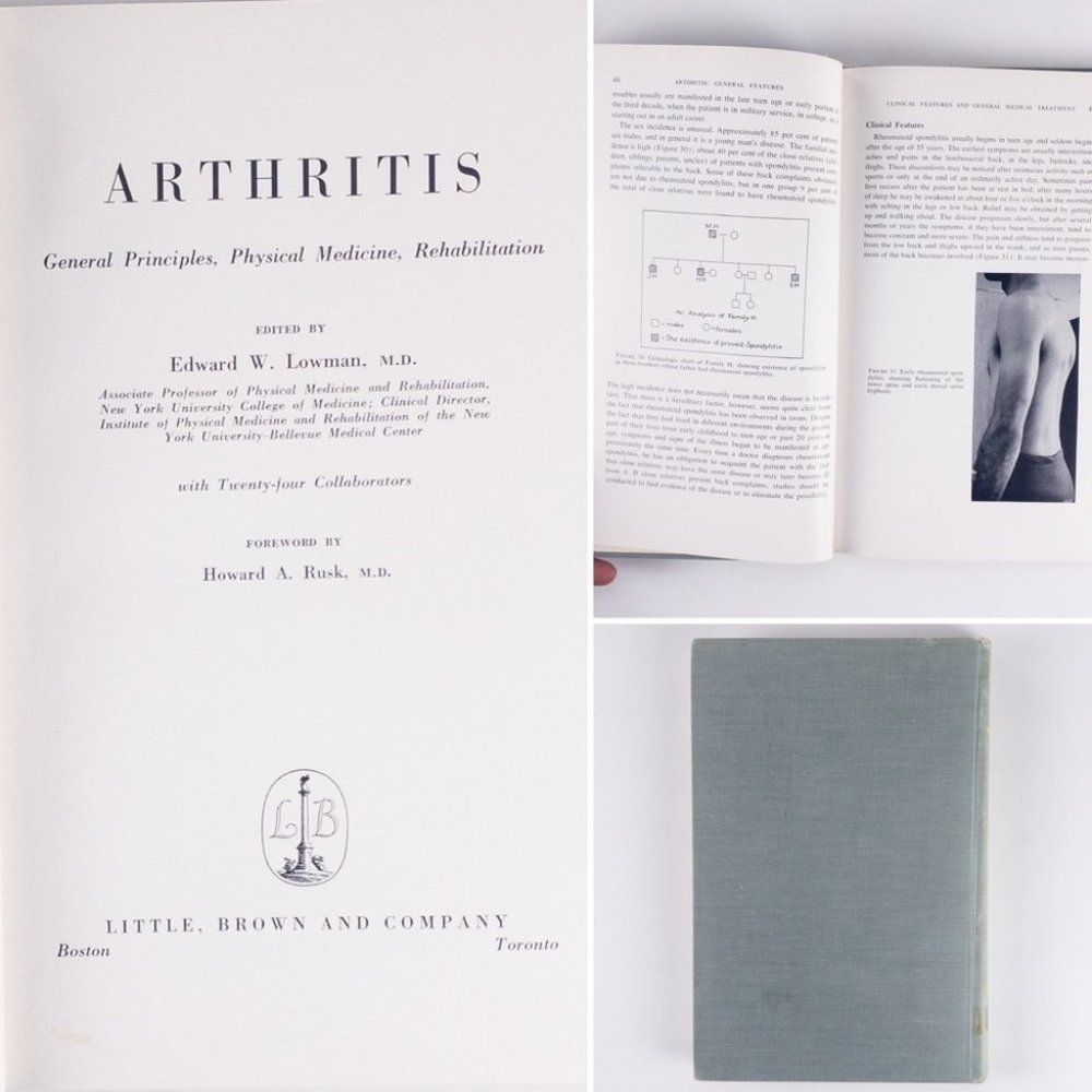 2/$50 - Arthritis General Principles by Edward Lowman
